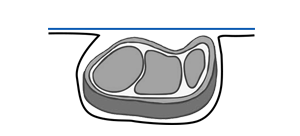 nkwakọ ngwaahịa agụụ na thermoforming